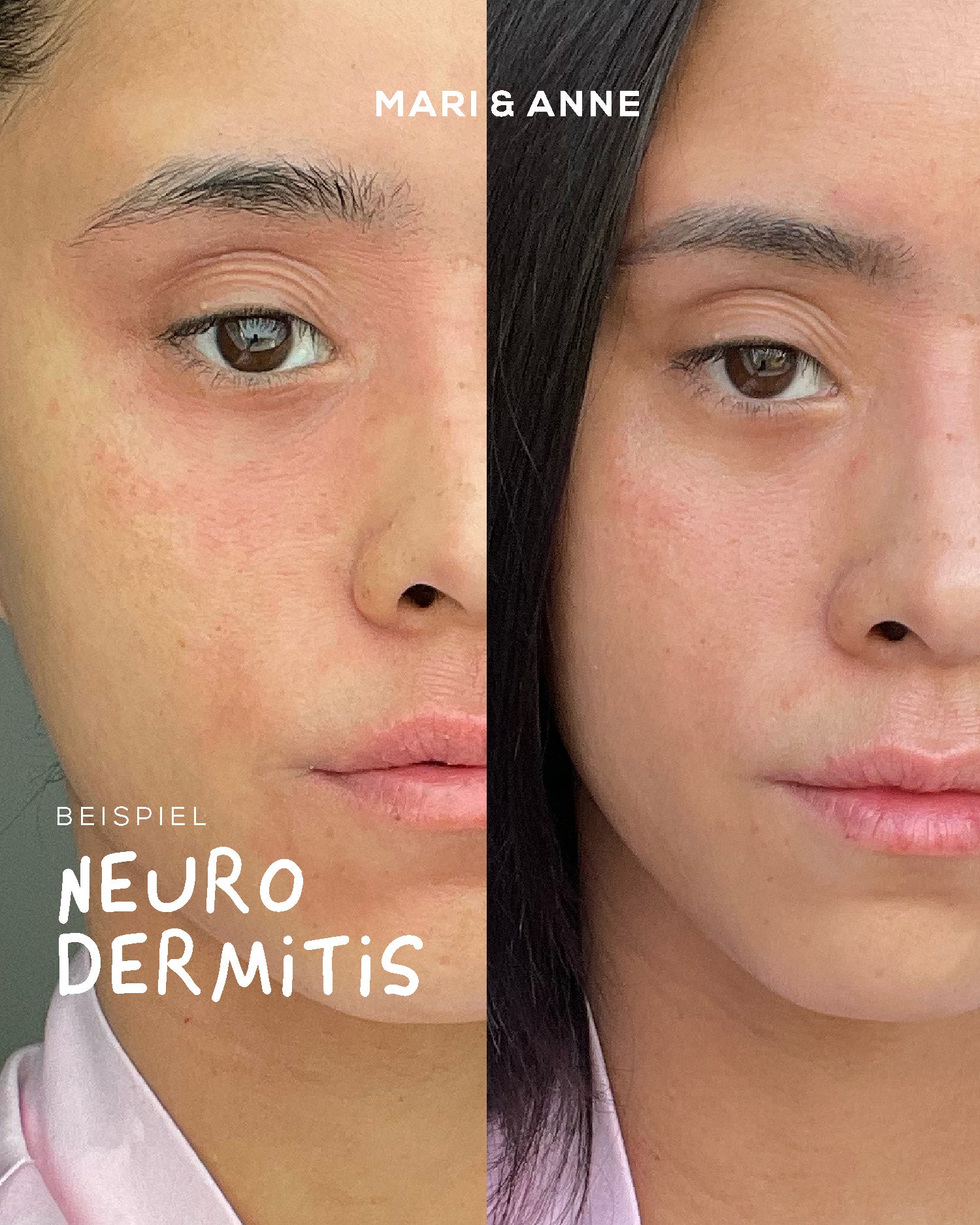 ALLESKÖNNER SENSITIV — RiNGELBLUMENSALBE